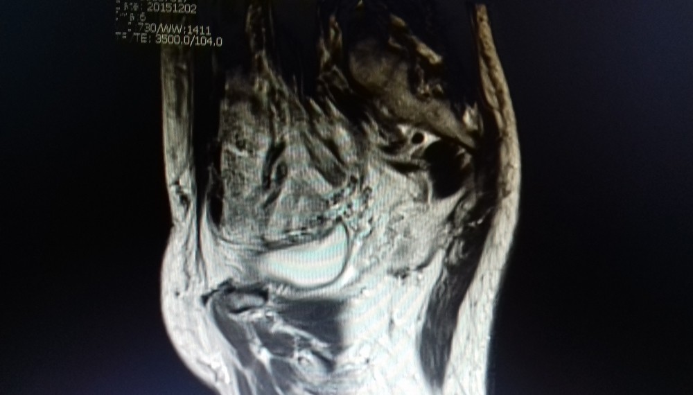 Ressonância Magnética da Coluna Cervical 